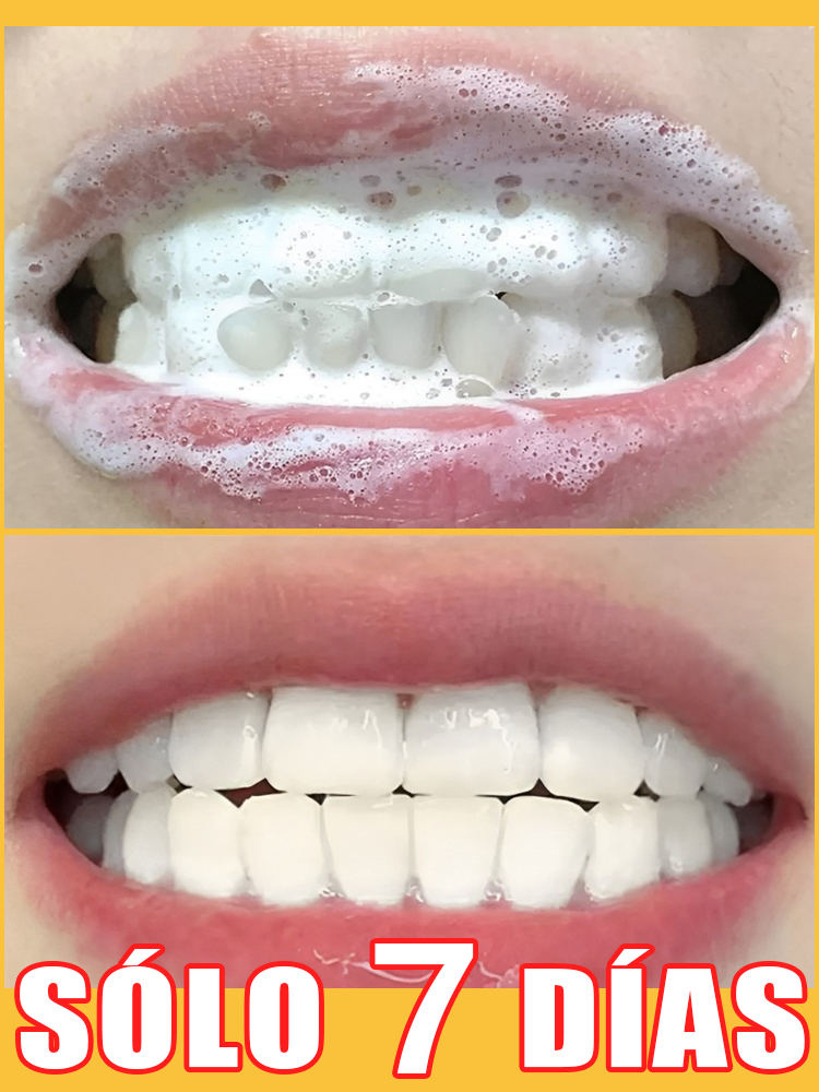 Blanqueamiento dental, restauración rápida y natural de las encías, críticas de usuarios abrumadoramente positivas