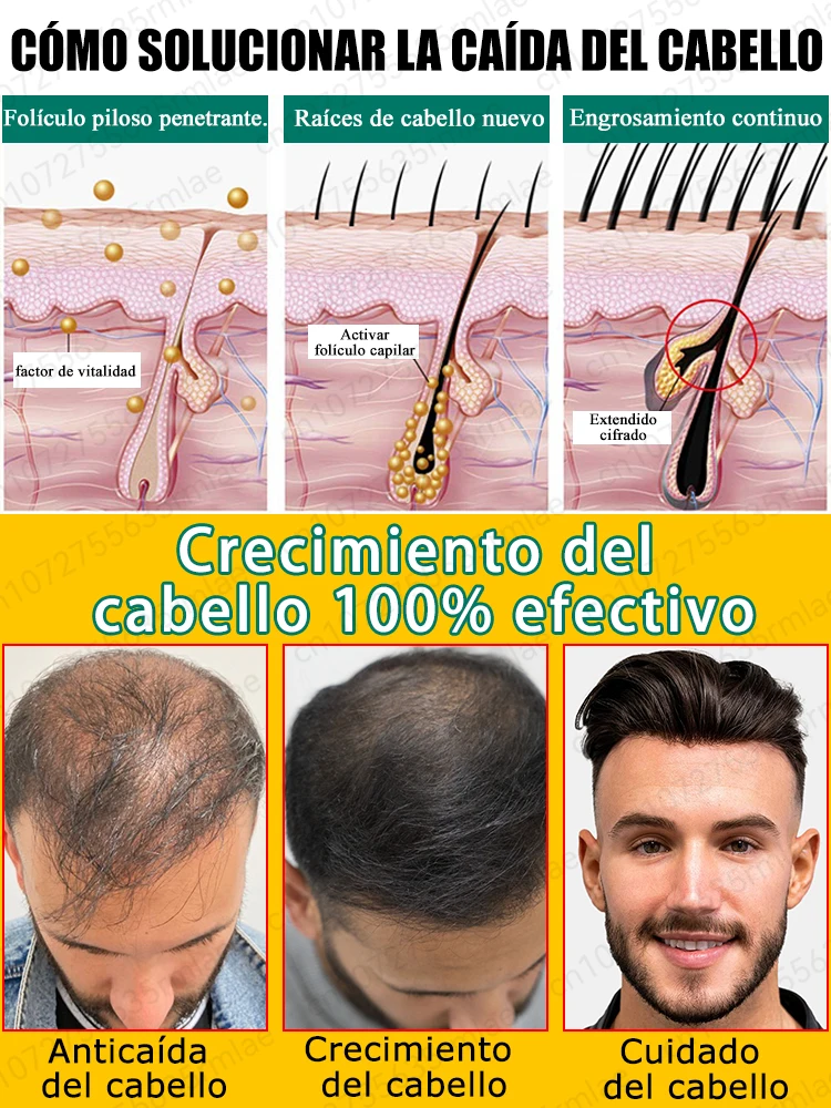 La pequeña botella azul de WPRBREGT nutre profundamente el cuero cabelludo, revitaliza los folículos pilosos y promueve el crecimiento rápido del cabello en 7 días.