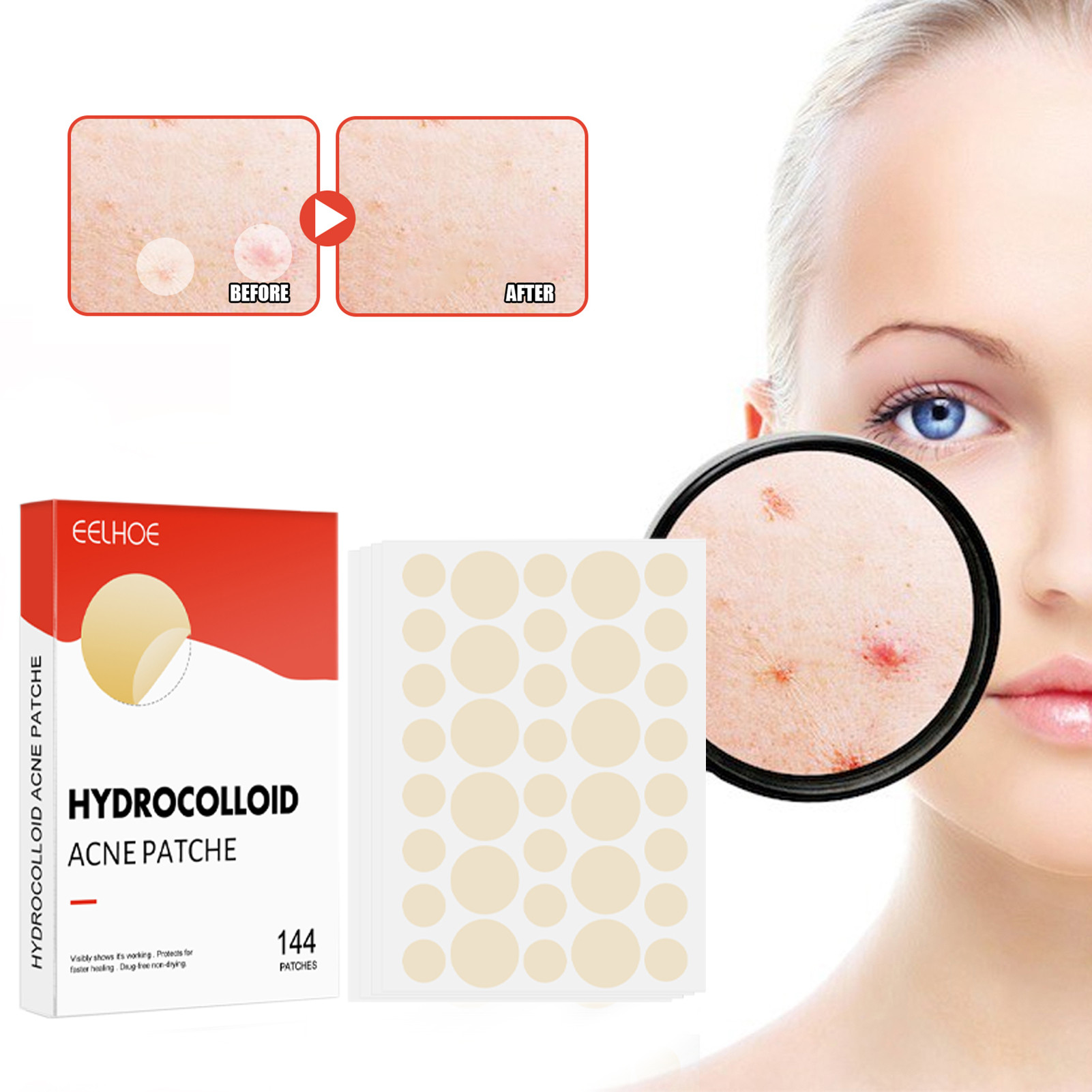 144 pz/set Viso Cura Della Pelle Acne Brufolo Patch 2 Formati Invisibile Guarigione Professionale Assorbente Spot Adesivo di Copertura per Le Donne Degli Uomini