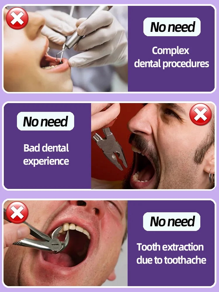 Reparación de caries dental Caries Caries Tratamiento anti-cías