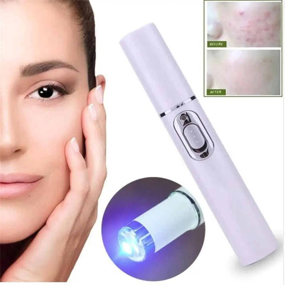Blue Light Eye Massager Color Box Size 167 * 60 * 35mm Relieve Eye Strain Improve Blood Circulation Reduce Dark Circles Powerful