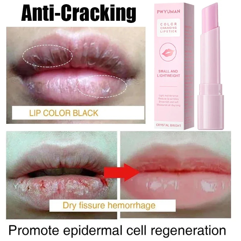 Quitar humo oscuro bálsamo labial aclarador melanina blanqueamiento brillo aceite labios lápiz labial rosa exfoliante desvanecimiento líneas de labios cosméticos Coreanos
