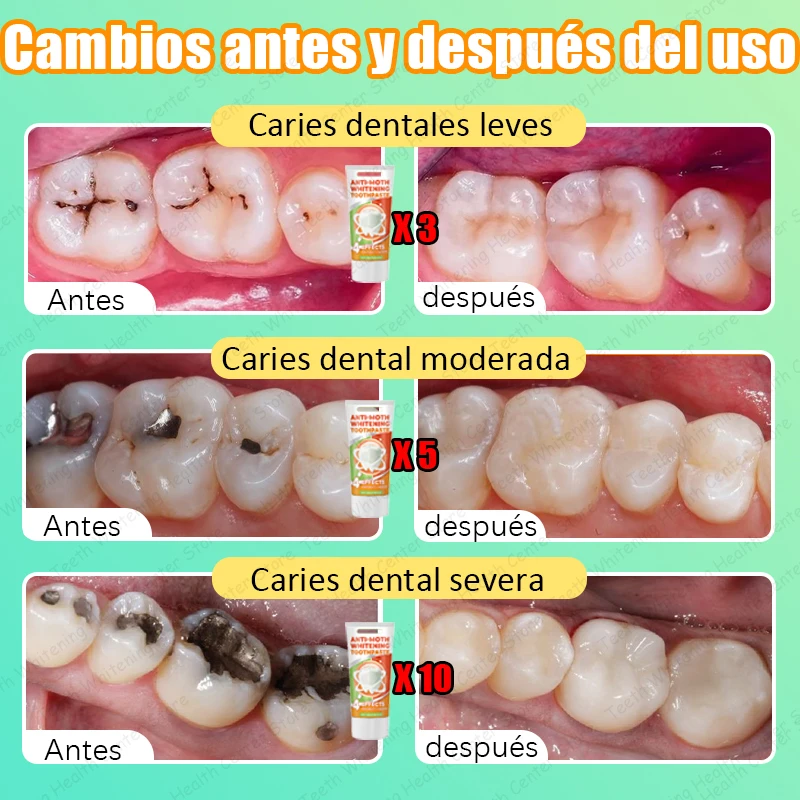99% ᴅᴇ ᴘᴇʀsᴏɴᴀs, ʀᴇᴄᴏᴍᴘʀᴀ, sᴜᴘᴇʀᴠᴇɴᴛᴀs, ғᴀ́ᴄɪʟ ᴅᴇ ᴜsᴀʀ, ʀᴇᴘᴀʀᴀ ʟᴀ ᴄᴀʀɪᴇs ᴅᴇɴᴛᴀʟ