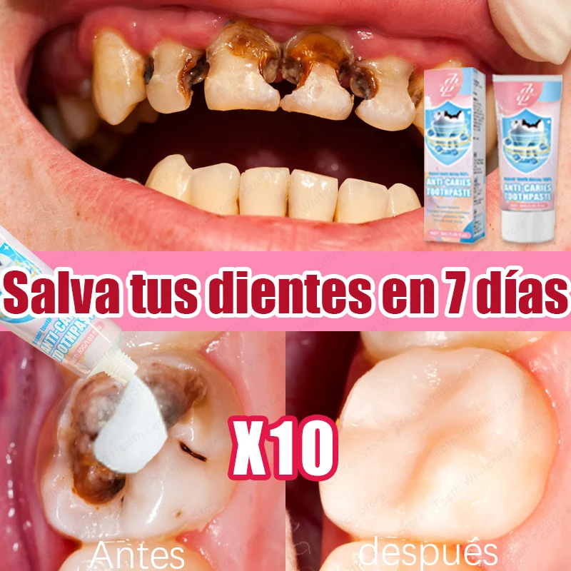 99% DE PERSONAS ʀᴇᴄᴏᴍᴘʀᴀ, Vᴇɴᴛᴀ ᴄᴀʟɪᴇɴᴛᴇ ᴘᴀʀᴀ ʀᴇᴘᴀʀᴀᴄɪᴏ́ɴ ᴅᴇ ᴄᴀʀɪᴇs ᴅᴇɴᴛᴀʟᴇs