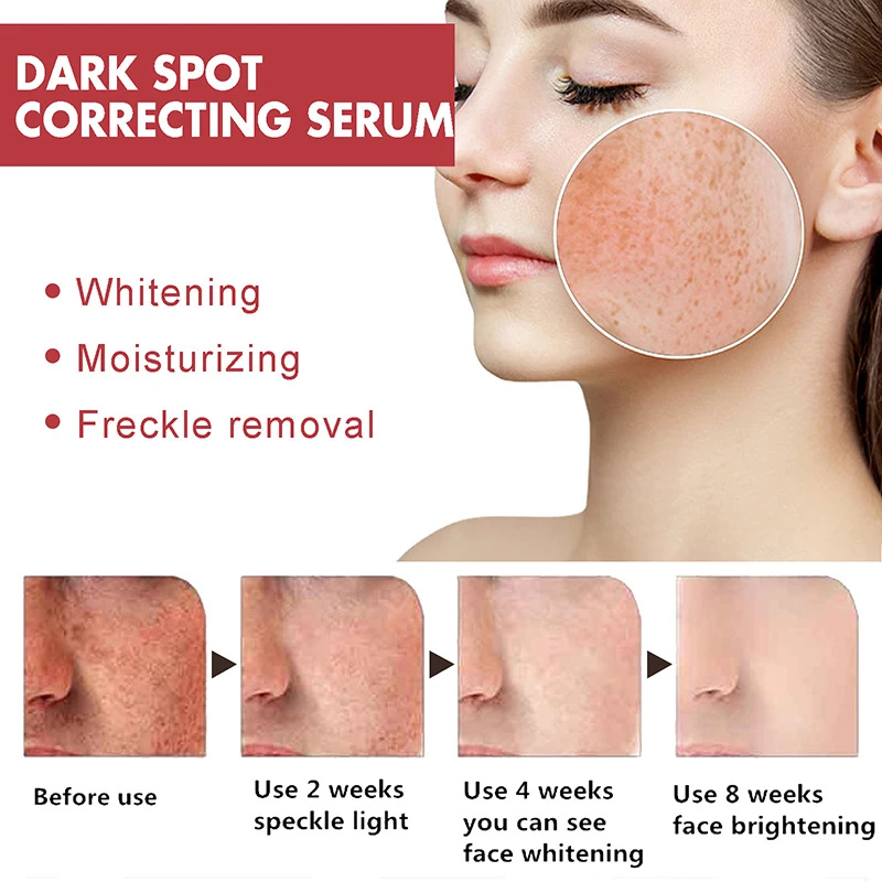 Suero de niacinamida, corrector de manchas oscuras, hidratante, brillo, decoloración de líneas finas, limpieza profunda, removedor de maquillaje, cuidado de la piel coreano