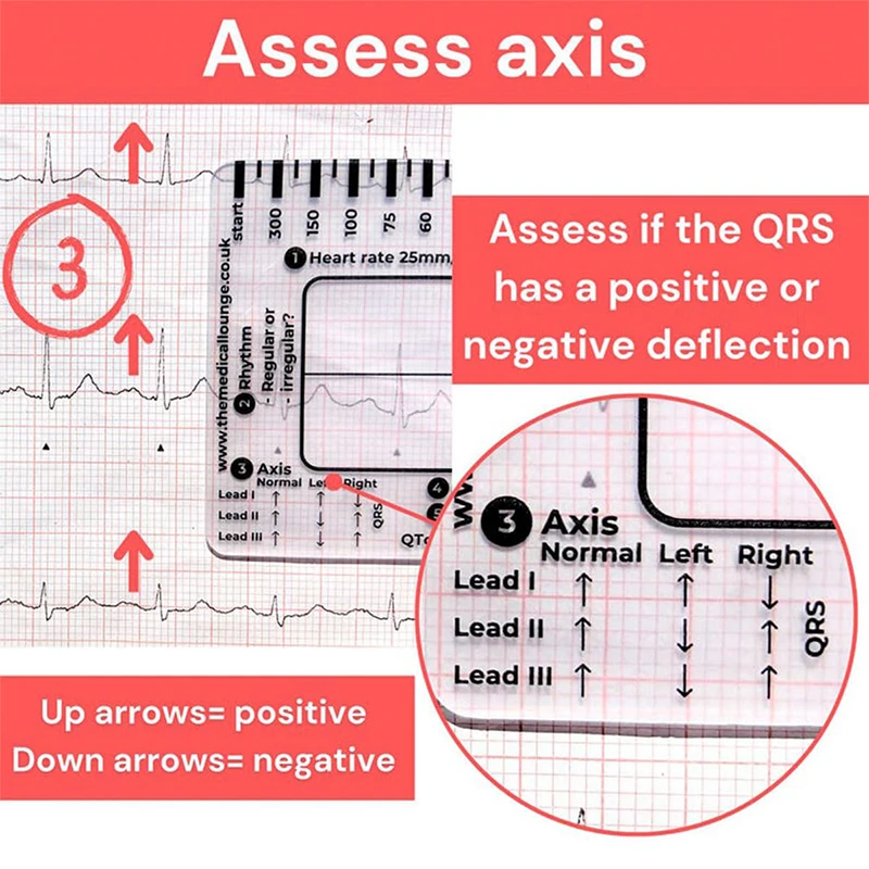 Ecg 7 Step Ruler 7 Step Scale For Ecg Observation Portable Transparent 7step Ruler Measurement Tool Ruler For Ecg Interpretation
