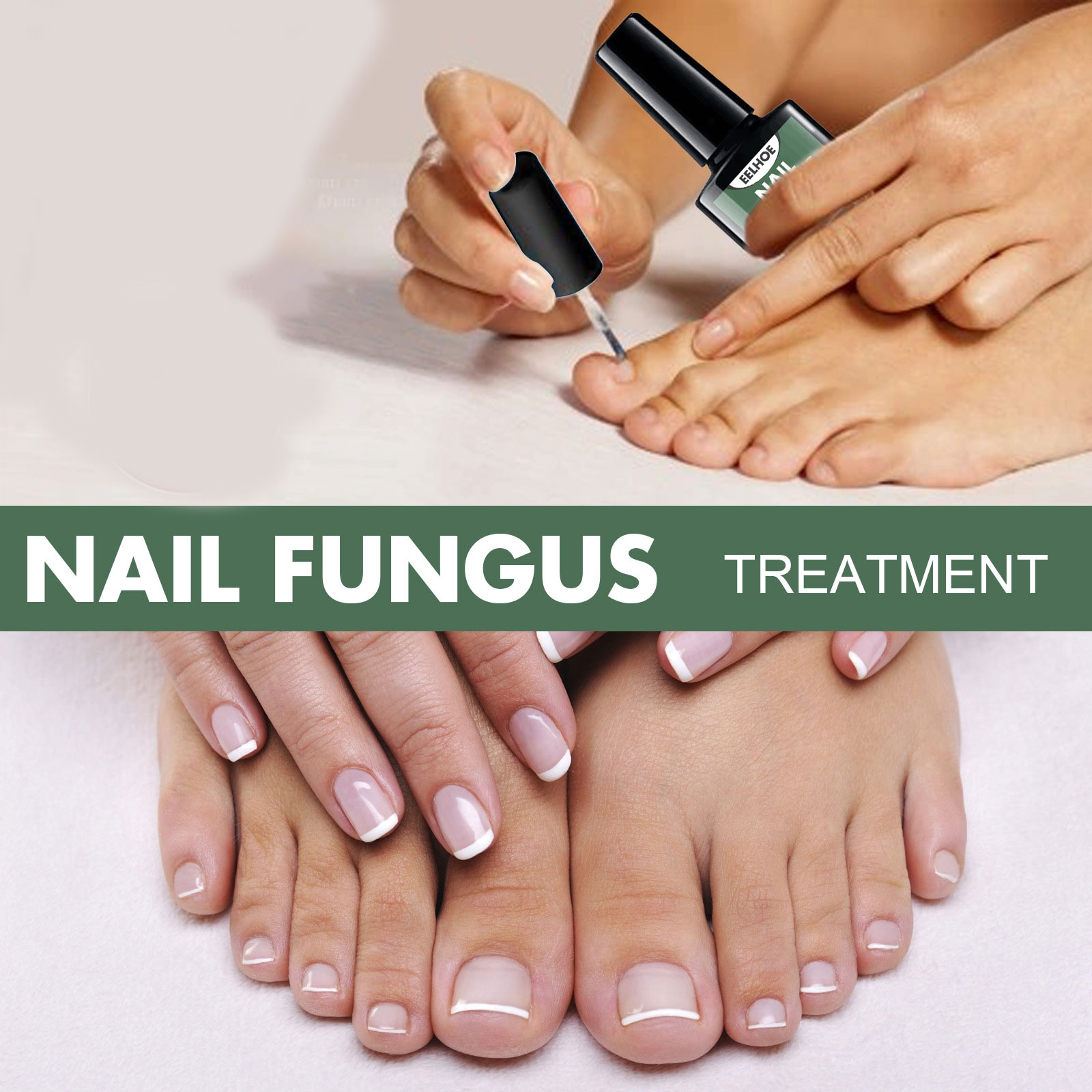 Tratamiento de hongos en las uñas, aceite esencial para eliminación de hongos en las uñas de los pies, reparación de suero, productos de cuidado de Gel antiinfección onicomicosis