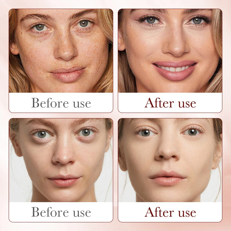 Сыворотка для улучшения шероховатости, разглаживания кожи лица