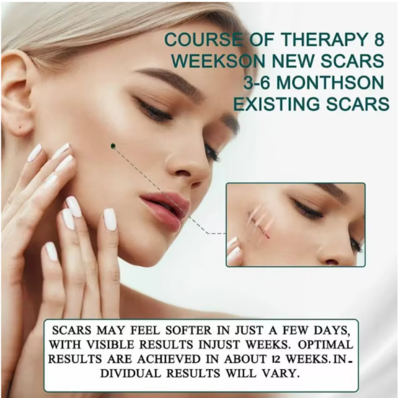 4cmx150cm Silicone Scar Sheets Removal Strips Silicone Gel Scar Strip For Acne Keloid Surgery Burn Treatment Scar Patch Hot Sale