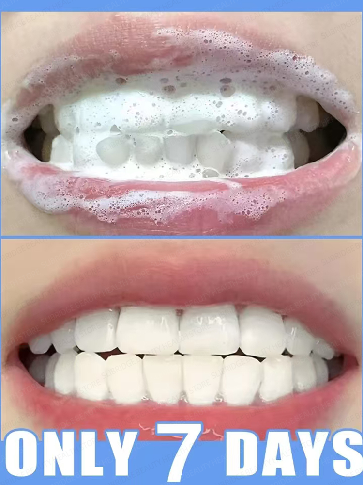 Tartar removers dissolve tartar and remove stains