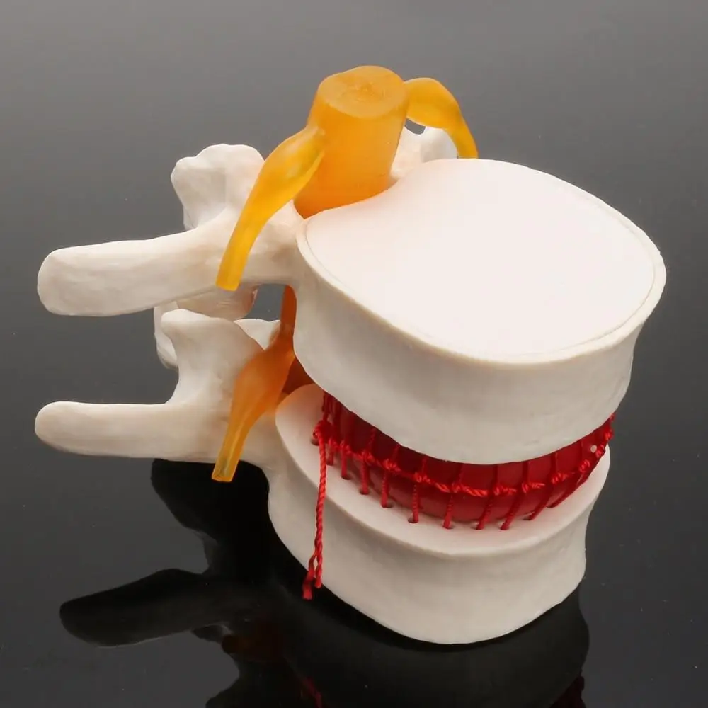 Anatomia człowieka Szkielet Kręgosłup Przepuklina dysku lędźwiowego Model nauczania Mózg Czaszka Traumatyczny pistolet Przybory szkolne Instrument medyczny