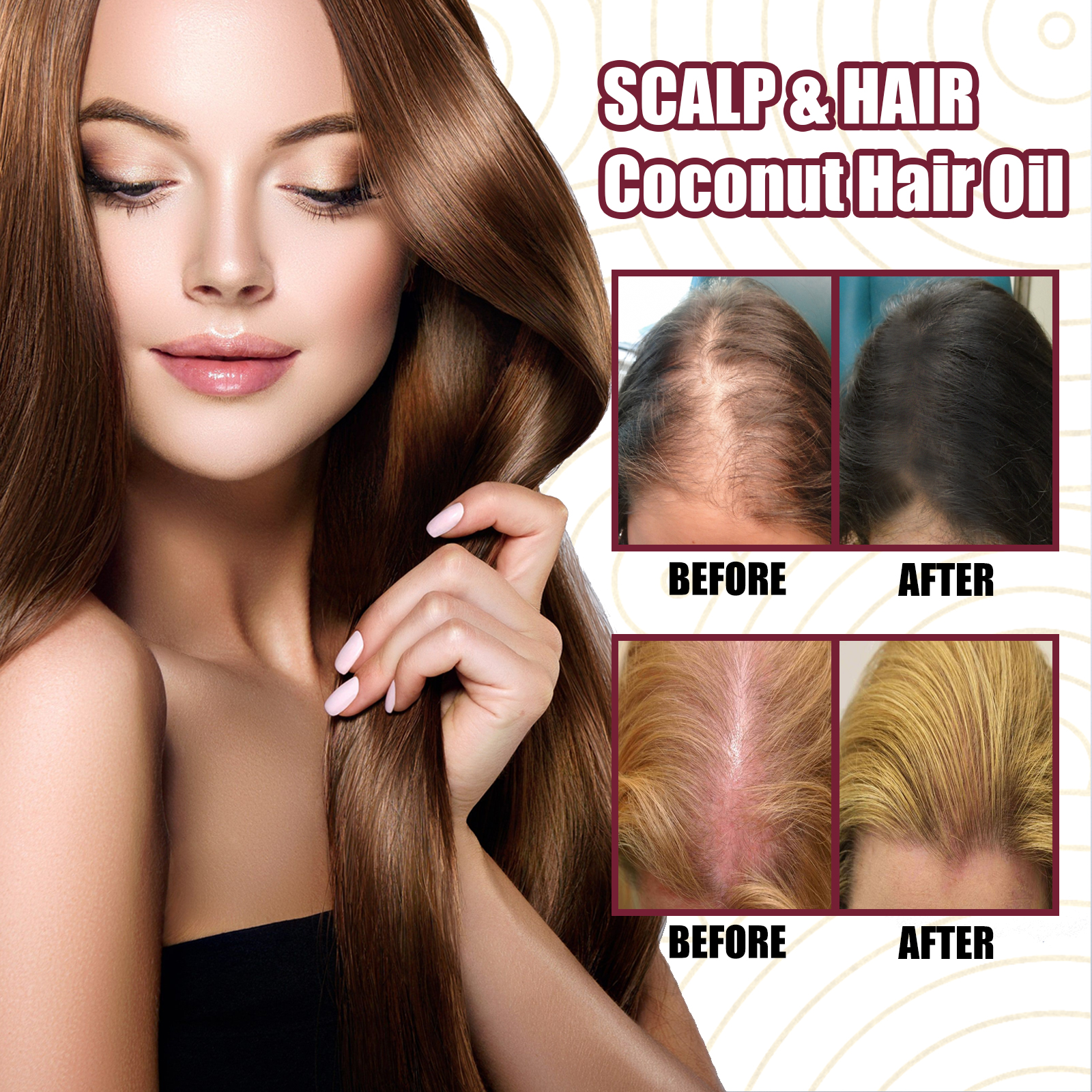 Red Onion Hair Growth Essential Oil Hair Care Spray Zapobiegaj wypadaniu włosów Odżywia korzenie włosów Popraw teksturę włosów Produkty do pielęgnacji włosów