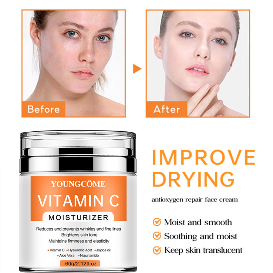 YOUNGCOME-VitaminC Creme Facial, SkinCare, Pigment Spots, Removedor de Sardas, Clareamento, Hidratante, Anit-Envelhecimento, Beleza, Saúde, Cosméticos