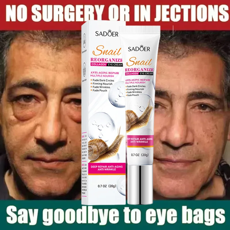 Snail Collagen Eye Cream Anti Dark Circles Remove Eyes Bags Moisturizing Firming Beauty Eyes Skin Care Products 2025 New