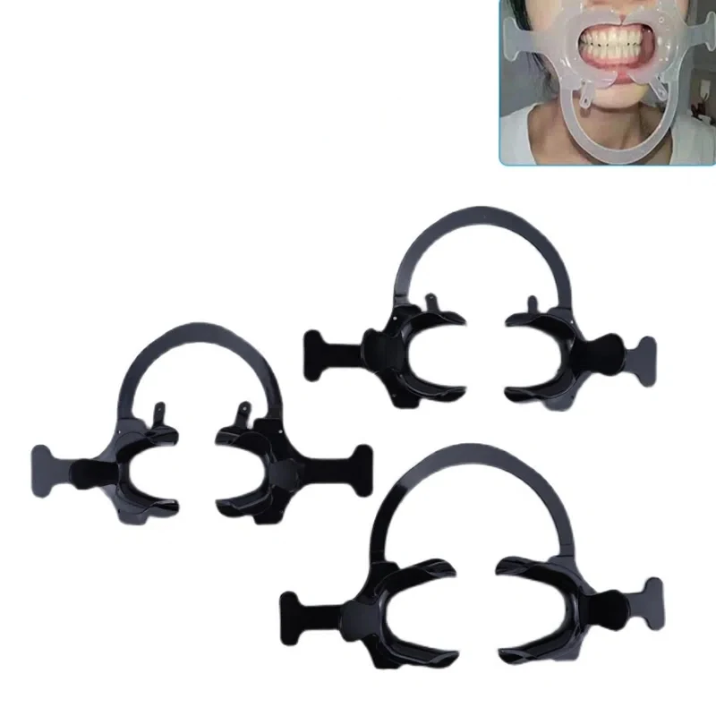 Dental Wangen Retraktor Kieferorthopädische Mund Opener C Form Seitliche Offene Dental Kieferorthopädische Schwarz Zahn Intraorale Lippe