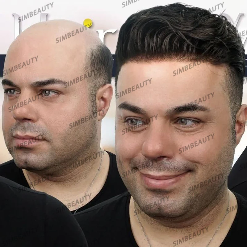 100% มนุษย์ผมผู้ชาย Toupee เส้นผมธรรมชาติผิว PU ฐานทนทานบาง 0.1 มม.ชายวิกผมเปลี่ยนหน่วย Capillary Prosthesis