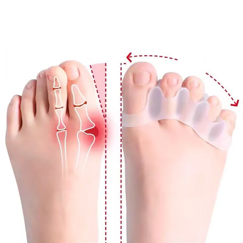 Separador de dedos de silicona, esparcidor de dedos, Hallux Valgus, Corrector de juanete, alisador de dedos, separadores de dedos, 2 uds.