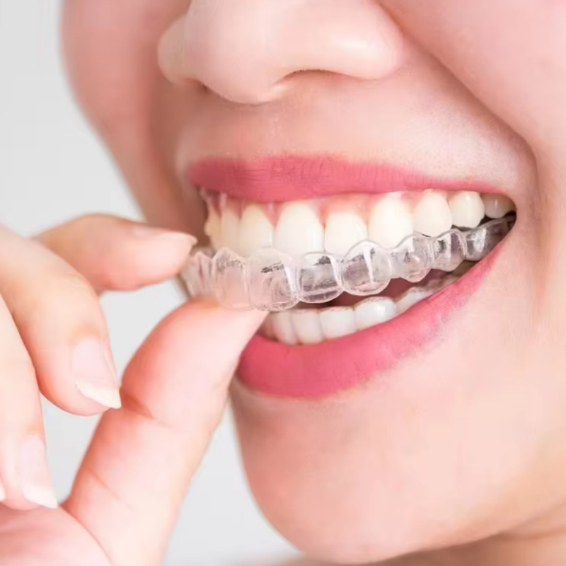 2-piece Teeth Tray Whitening Braces For Oral Hygiene Care Bleaching Teeth Tools