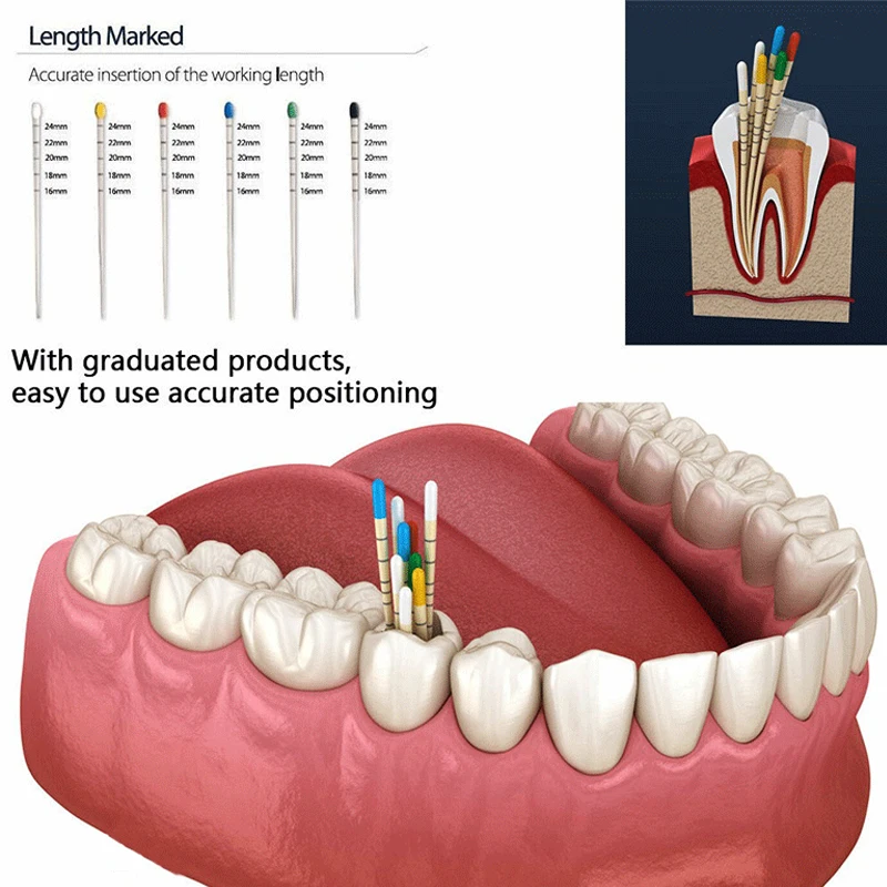 TJDent Dental Gutta taper 02 04 06 15 # -40 #   F1 F2 F3 F4 F5 Ze skalą Endodoncja Papier chłonny Materiały stomatologiczne Materiały eksploatacyjne