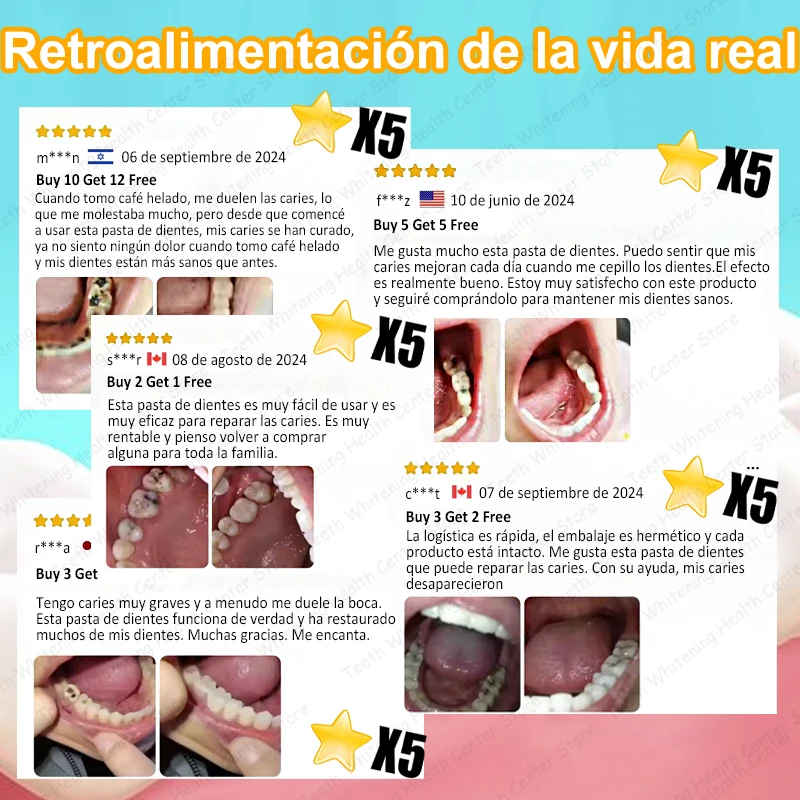 99% ᴅᴇ ᴘᴇʀsᴏɴᴀs, ʀᴇᴄᴏᴍᴘʀᴀ, sᴜᴘᴇʀᴠᴇɴᴛᴀs, ғᴀ́ᴄɪʟ ᴅᴇ ᴜsᴀʀ, ʀᴇᴘᴀʀᴀ ʟᴀ ᴄᴀʀɪᴇs ᴅᴇɴᴛᴀʟ
