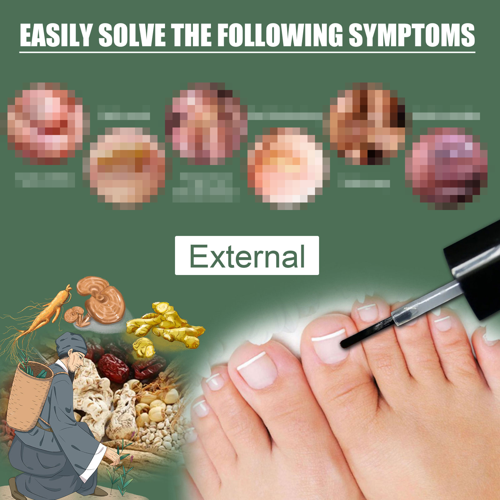 Tratamiento de hongos en las uñas, aceite esencial para eliminación de hongos en las uñas de los pies, reparación de suero, productos de cuidado de Gel antiinfección onicomicosis