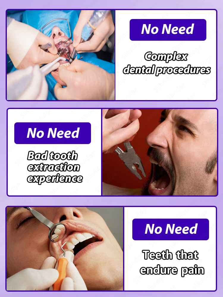 Reparación de caries dental Reparación de caries antiprotección de caries