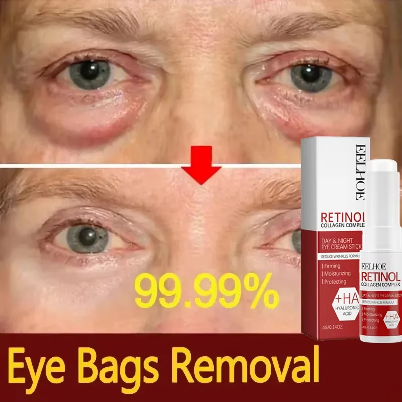 Crema para ojos con Retinol, barra multibalm de colágeno, Reduce las arrugas, bolsa para ojos, ácido hialurónico, antiojeras, hinchazón, productos para el cuidado de los ojos