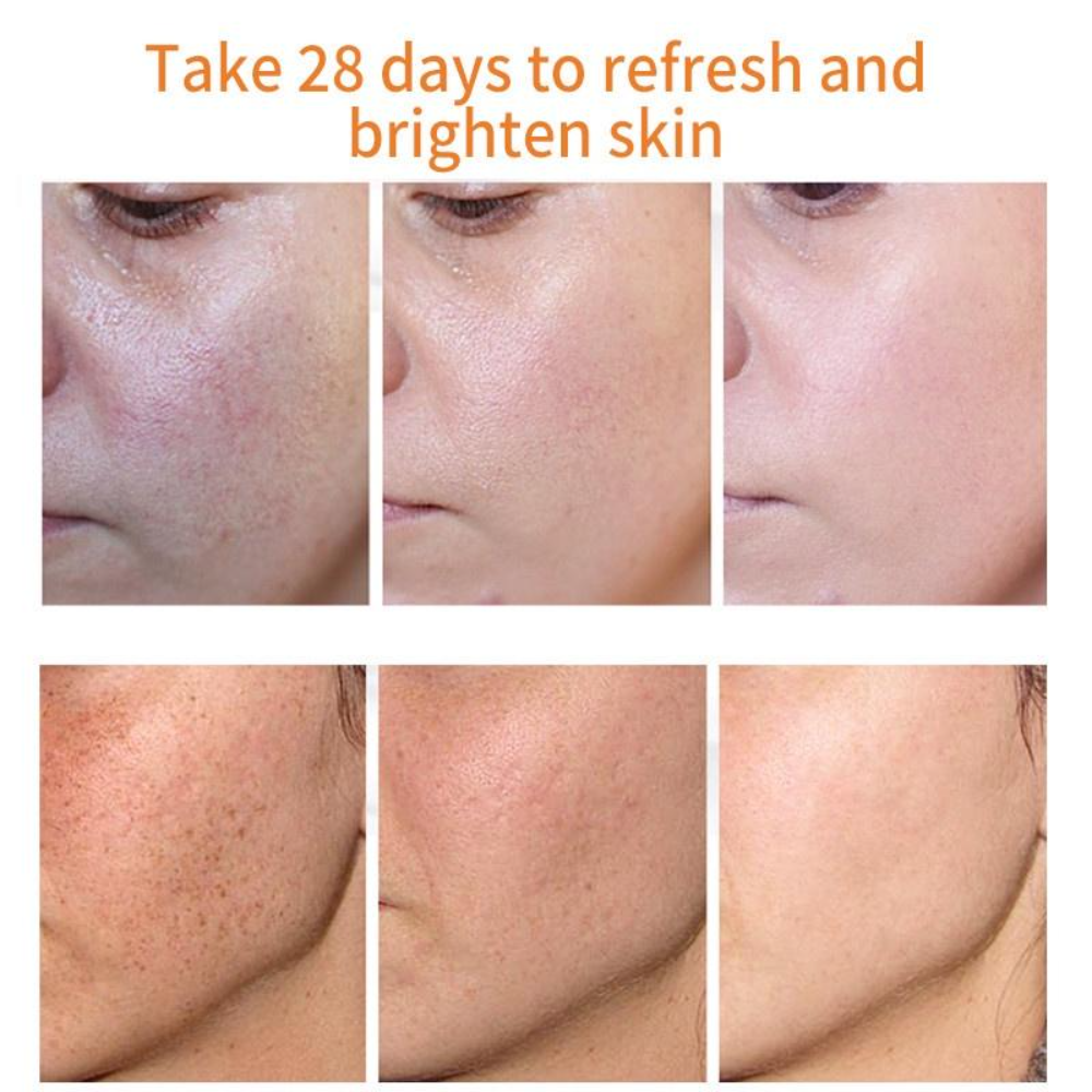 Effective Whiten Freckle Cream Remove Melasma Dark Spot Anti-pigmentation Brighten Face Improve Dullness Cream Skin Care Cream