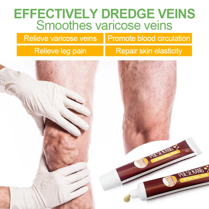 1 Chiếc Suy Giãn Tĩnh Mạch Điều Trị Kem Loại Bỏ Hồng Vệt Giãn Tĩnh Mạch Thừng Tinh Viêm Mạch Phlebitis Tăng Cường Mao Mạch Sức Khỏe S034