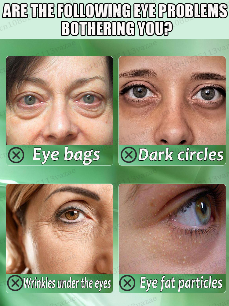 оставайся подогревом эссенции для глаз, сохраните свои глаза навсегда молодые