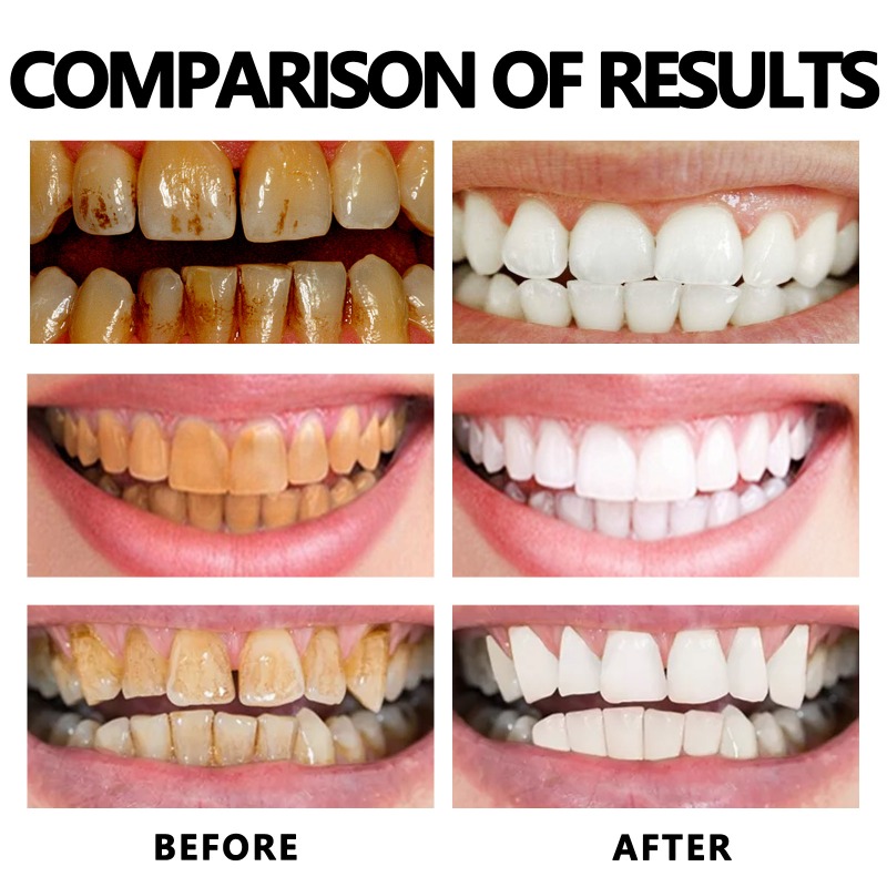 Gum Regrowth Foam Brighten Whitening Yellow Teeth Toothpaste Foam Cleaning Effective Removing Tooth Stain Oral Cleaning Product