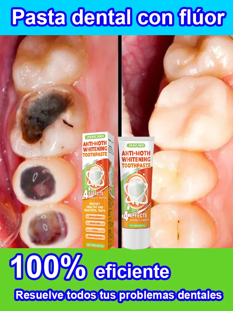 Reparación de dentífrico, pasta de dientes blanqueadora