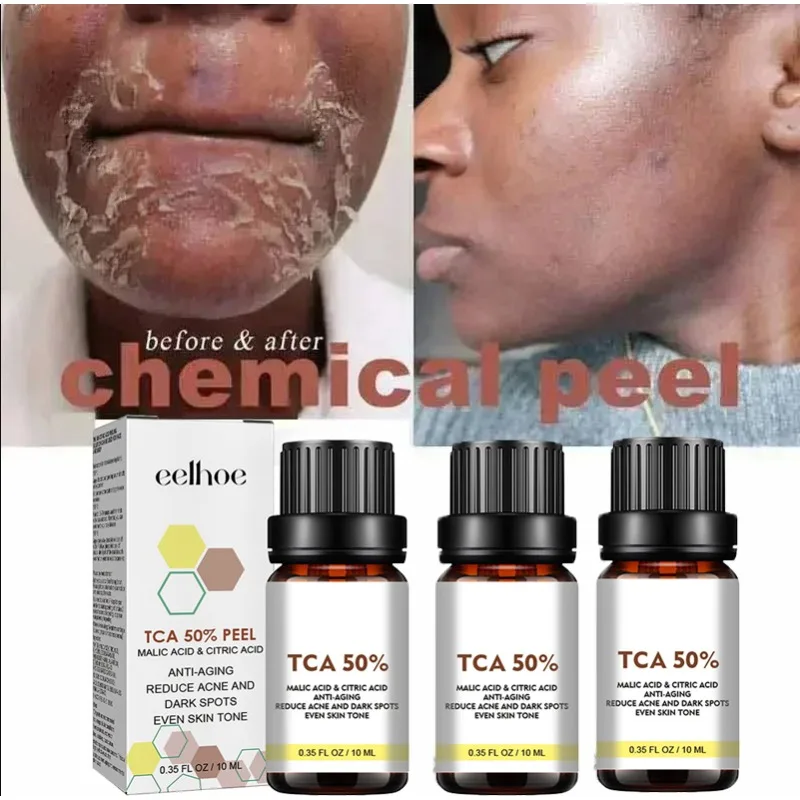 Face Care Exfoliating Radiant Skin Fade Dark Spots & Pigmentation for Even Brighter Skin Remove Spots Arm Knee Legs Melanin
