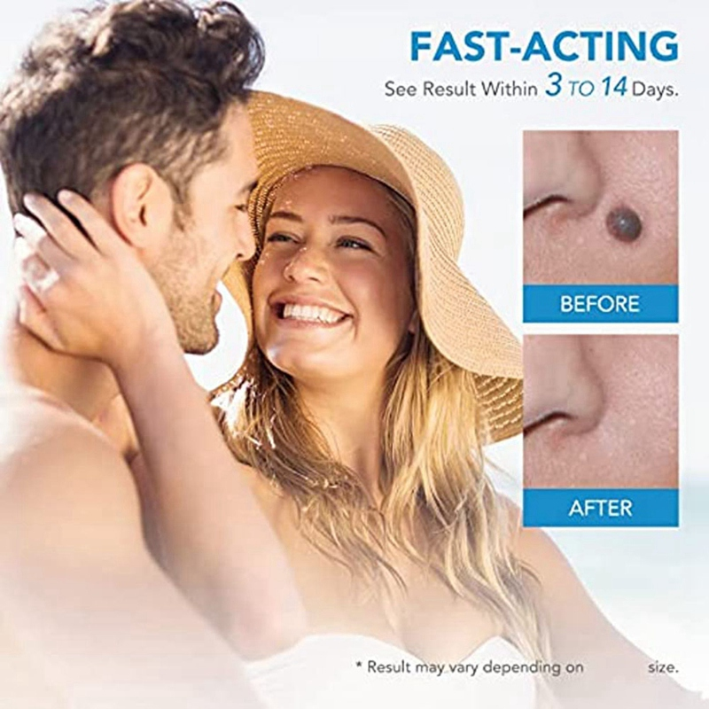 2 In1 Painless Auto Skin Tag Mole Wart Removal Kit Skin Care Body Wart Dot Treatments Remover Cleaning Tools