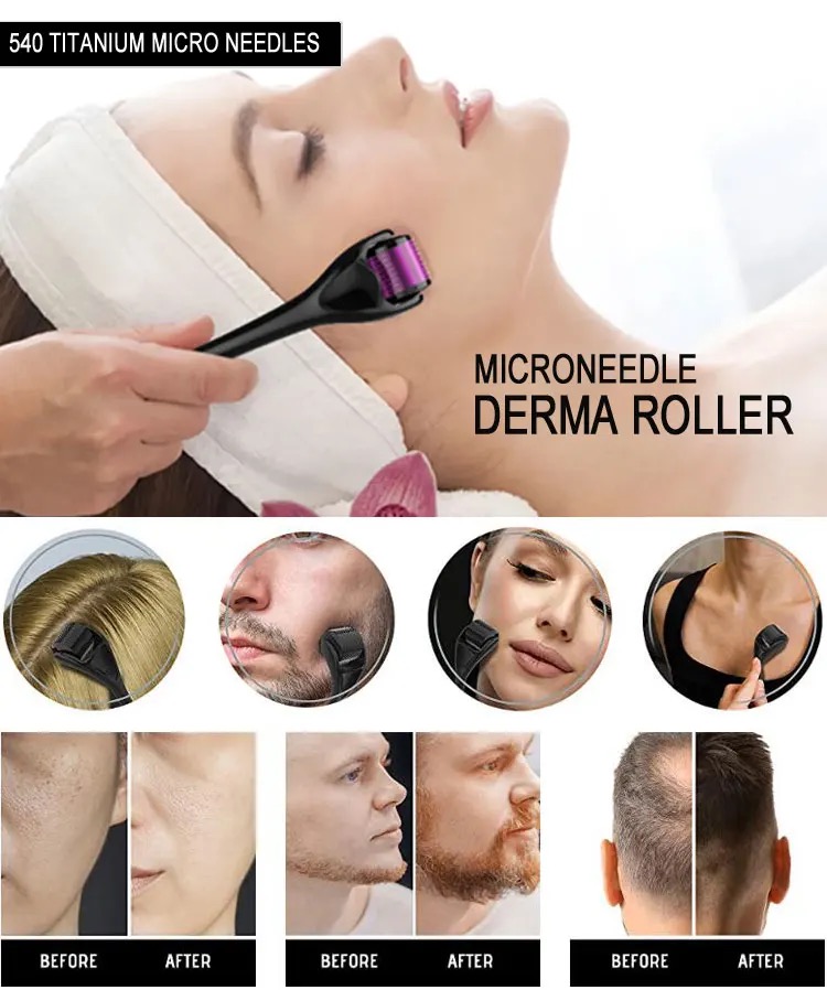 0,25 0,3 mm 540 Derma Roller Titanum Micronaald voor huidverzorging Lichaamsbehandeling Microneedle MTS