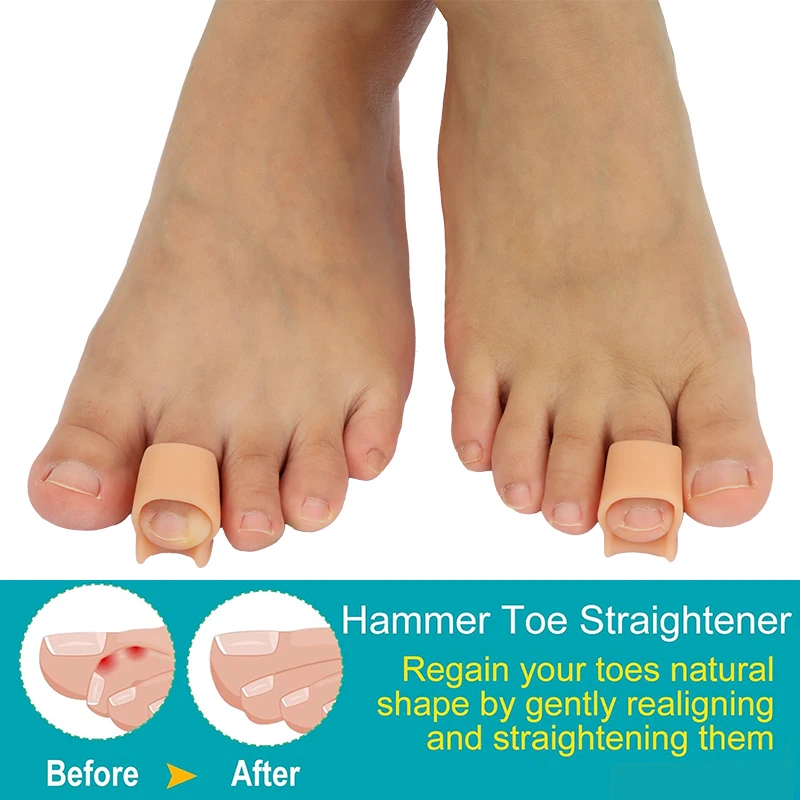 Pexmen 2/4 ชิ้น Hammer Toe Straightener Hammertoe Corrector สําหรับม้วนโค้งงอและ Claw Toes Lift Toe Tip Toe Cushion