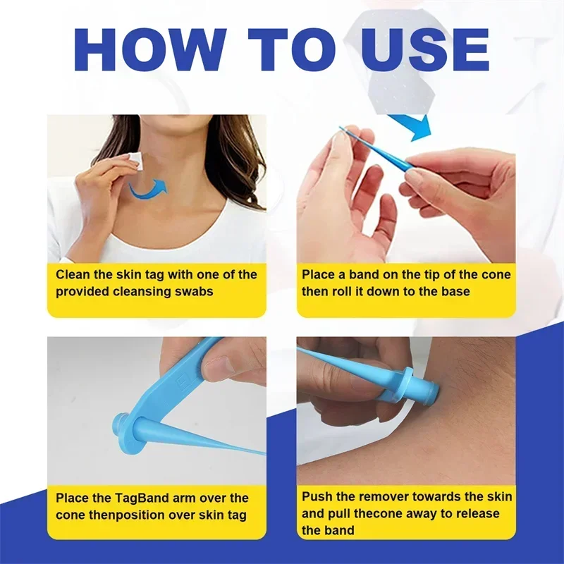 1 Set Skin Tag Removal Kit Skin Mole Wart Remover Micro Band Skin Tag Removal Kit Tag Treatment Tools Set with Cleansing Swabs
