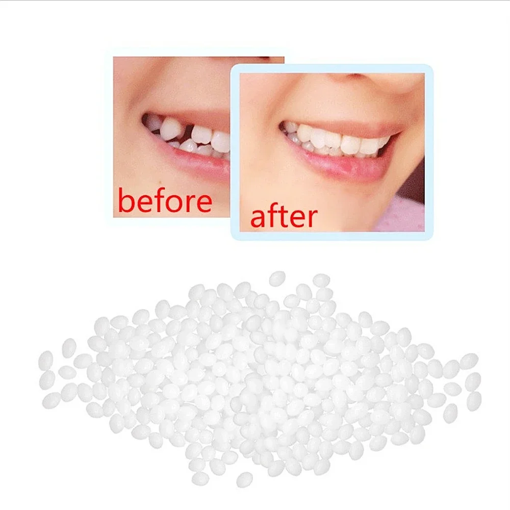Gránulos de reparación temporal de dientes de resina, 50g, huecos de dientes faltantes, relleno de dientes rotos, dentaduras postizas adhesivas moldeables, herramientas para dientes postizos