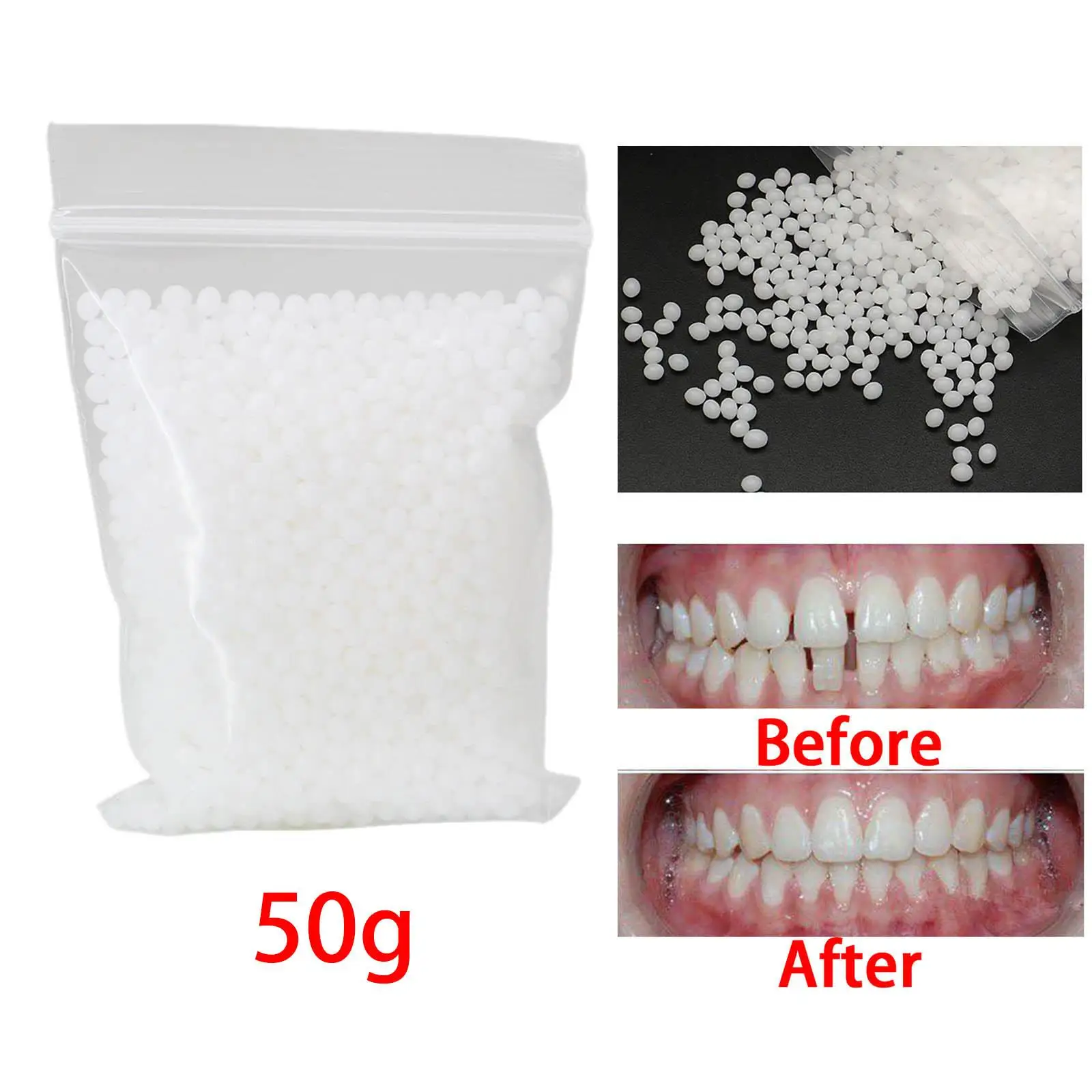 Kit de reparación temporal de dientes 50G, cuentas adhesivas, chapa de dientes falsos moldeable