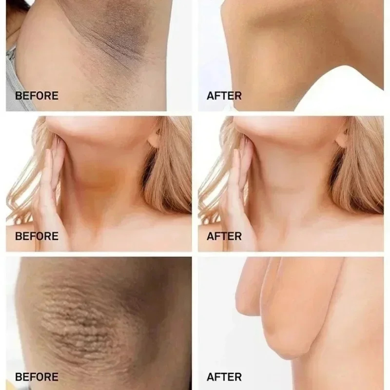 Nicotinamide Brightening Cream For Dark Skin Effective Lighten Thigh Inner Bleach Remove Melanin Private Parts Brighten CreamNEW