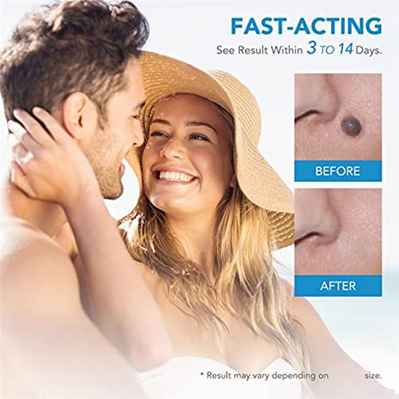 2 In1 Painless Auto Skin Tag Mole Wart Removal Kit Skin Care Body Wart Dot Treatments Remover Cleaning Tools