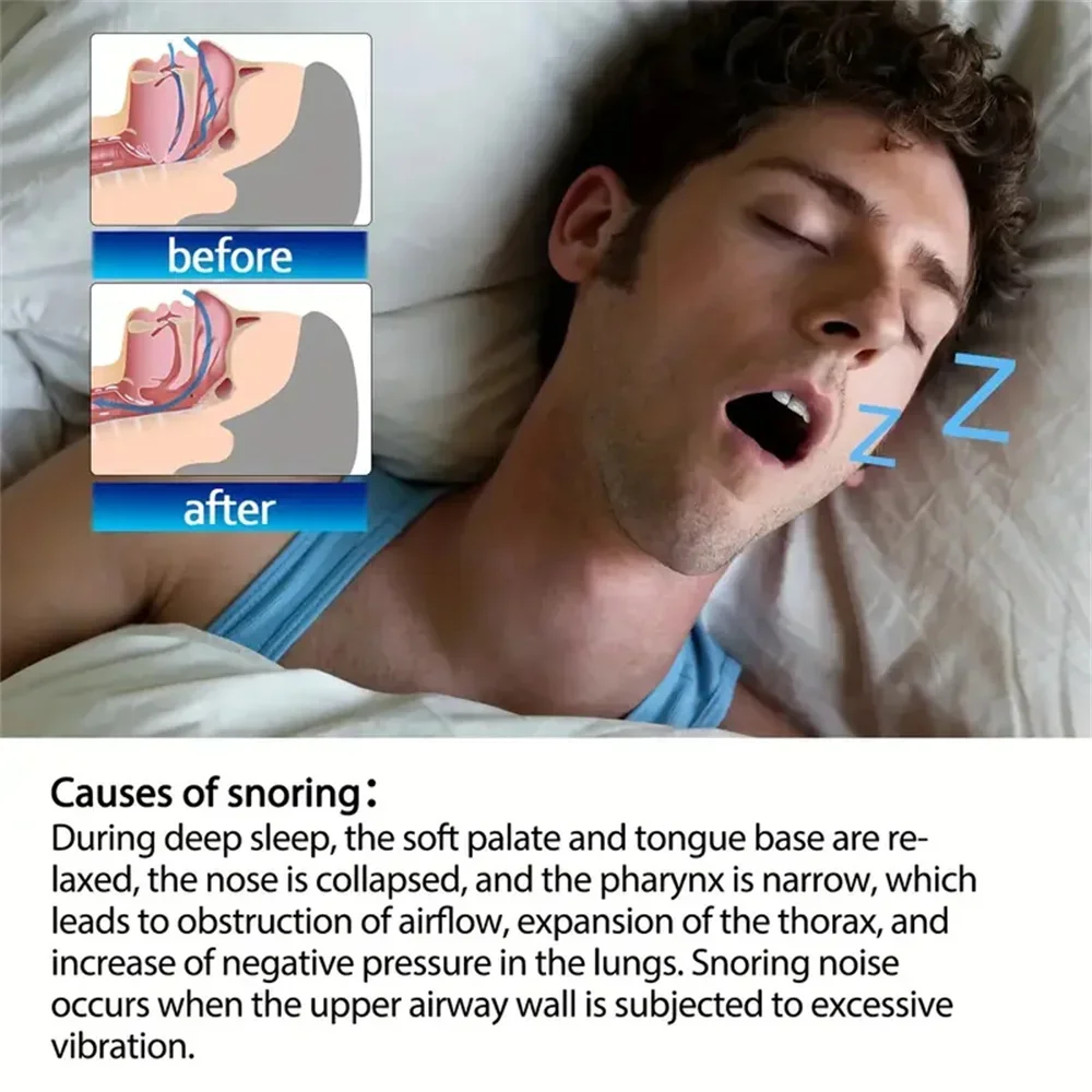 50-200 Stuks Snurken Stickers Ademhaling Neus Strips Fysieke Luchtweg Uitbreiding Voor Verbeterde Vent Anti Comfort Slaaphulp