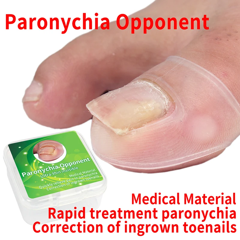 1Pair Silicone Ingrown Toenail Correction Tool Invisible Ingrown Toe Nail Treatment Elastic Straightening Clip Brace Pedicure 