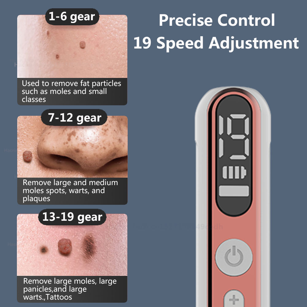 Laser Plasma Stift schwarze Punkte Maulwurf Warze Entferner Stift dunkle Flecken Entferner für Gesicht Körper Makel Entfernung Laser Stift Haut Tag Entfernung