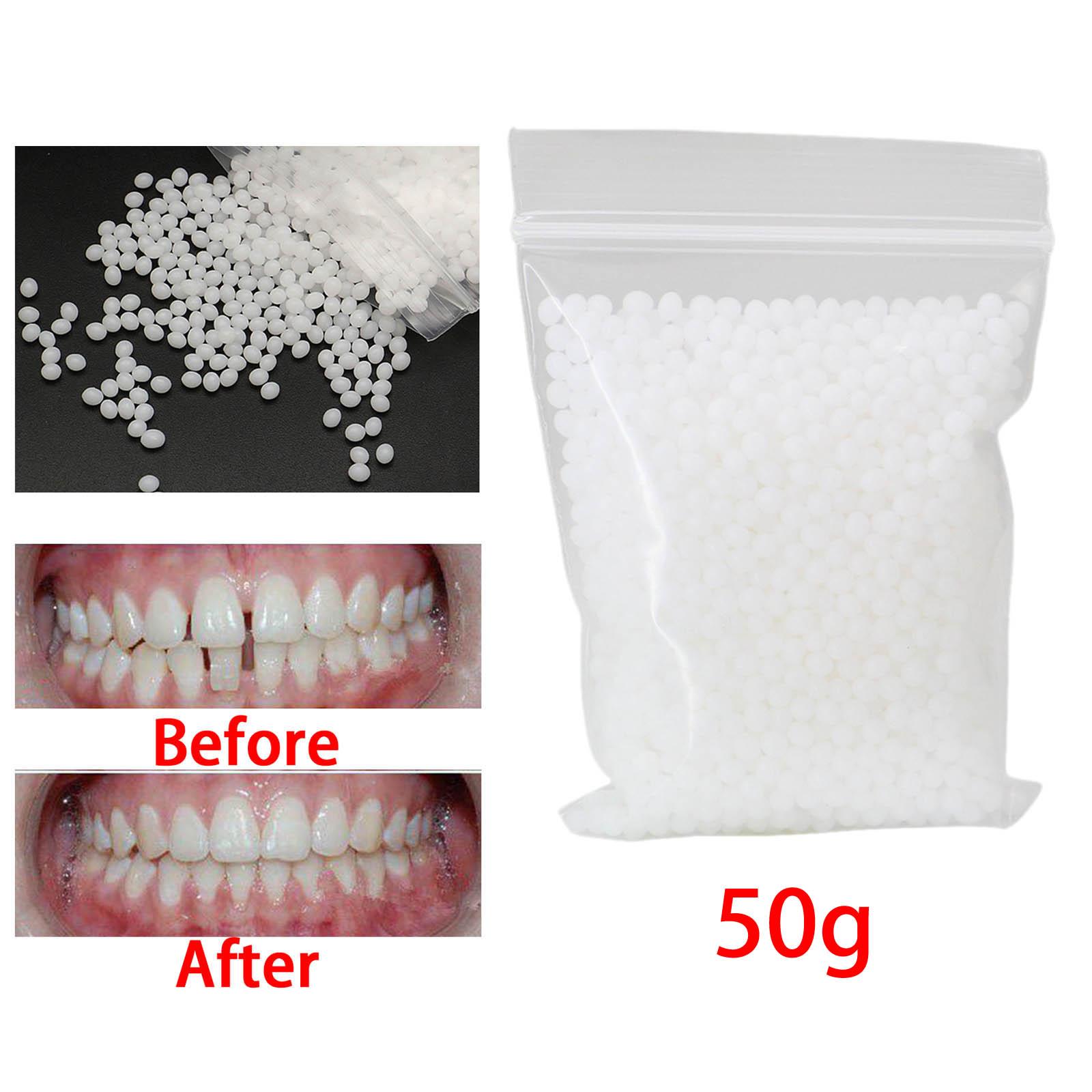 Kit de reparación temporal de dientes 50G, cuentas adhesivas, chapa de dientes falsos moldeable