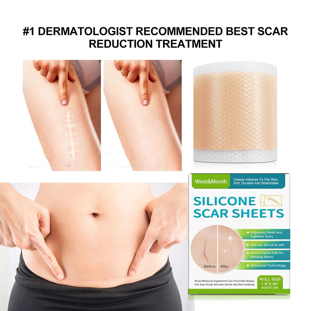 1/2 шт., силиконовые Пластыри для удаления шрамов