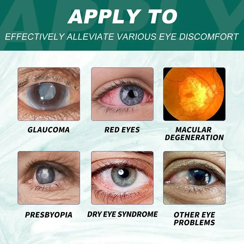 Gotas para los ojos alivia el molestio de los ojos ojos borrosos cuidado de los ojos doloroso picazón relaja la hinchazón seca masaje limpio