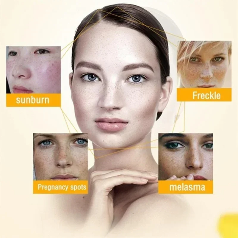 Remover rugas creme retinol rosto anti-envelhecimento endurecimento levantamento desvanece-se linhas finas melhorar a secura da pele hidratante iluminar cuidados com a pele
