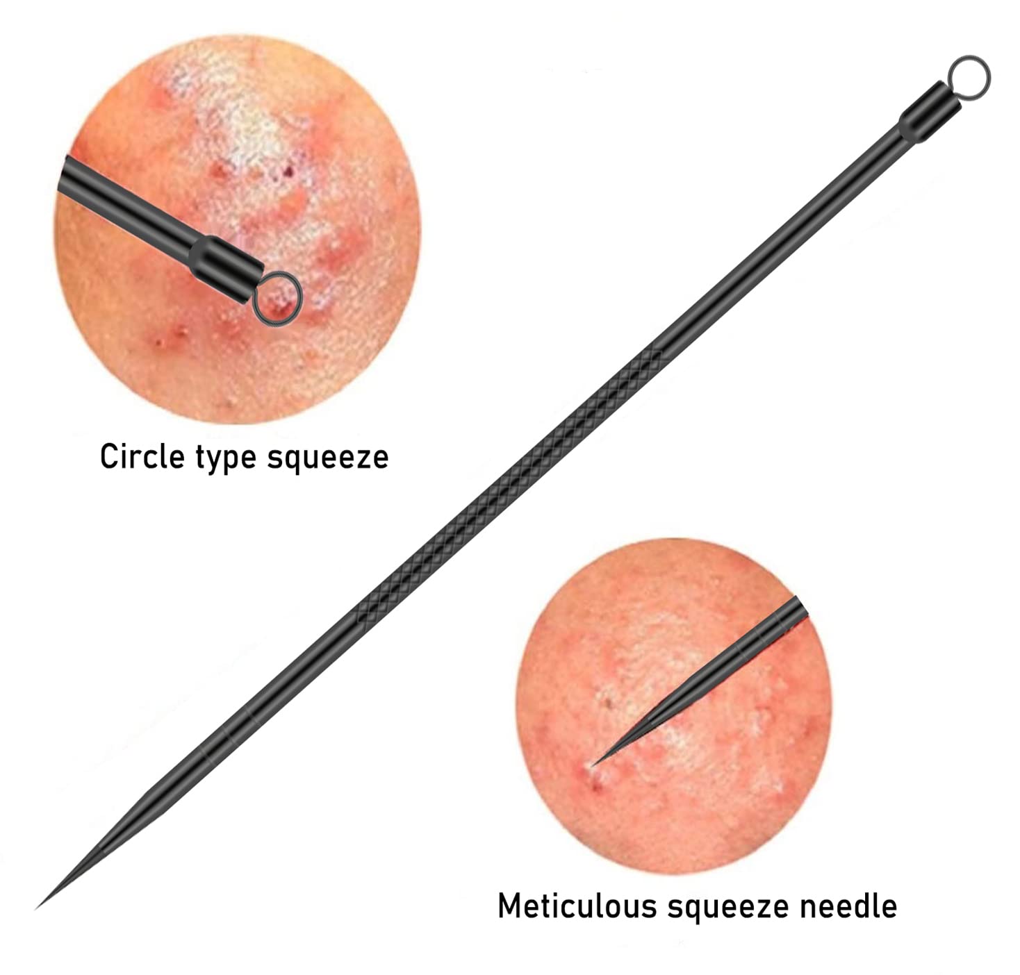 4 Professional Facial Blackhead เข็มชุดสิว Whitehead Blackhead EXTRACTOR สแตนเลส,เครื่องมือทําความสะอาดใบหน้าลึก
