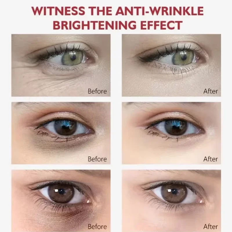 Crema para ojos con Retinol, barra multibalm de colágeno, Reduce las arrugas, bolsa para ojos, ácido hialurónico, antiojeras, hinchazón, productos para el cuidado de los ojos